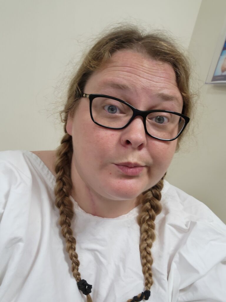 My Breast Reduction Journey: Pain, Guilt, and Finding Myself. Moon face and all